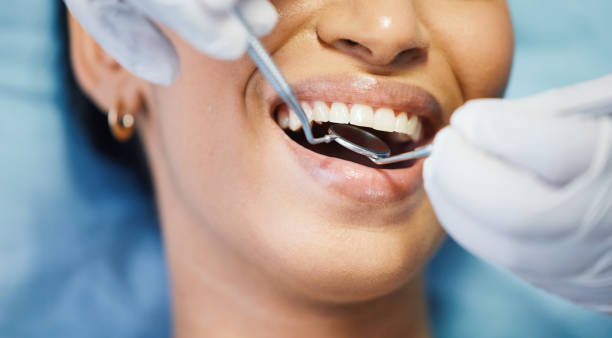 Best Emergency Dental Care for Broken or Chipped Teeth in , NM